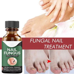 Fast Nail Fungal Treatments Nail Repair Essences Serum - Mall Mega