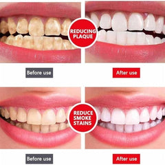 Yayashi Sp - 4 Ultra Whitening Toothpaste Probiotic Stain Remover 100ml - Mall Mega