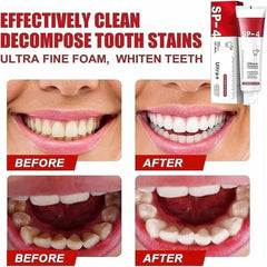Yayashi Sp - 4 Ultra Whitening Toothpaste Probiotic Stain Remover 100ml - Mall Mega