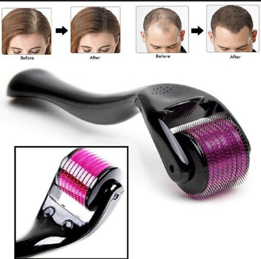 Derma Roller System 540 Needles - Mall Mega